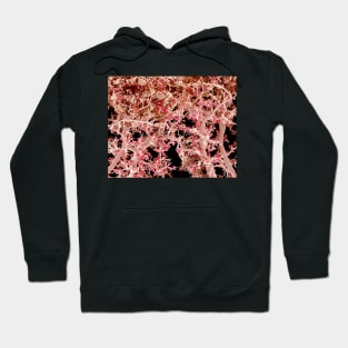 Kidney blood vessels, SEM (C022/7915) Hoodie